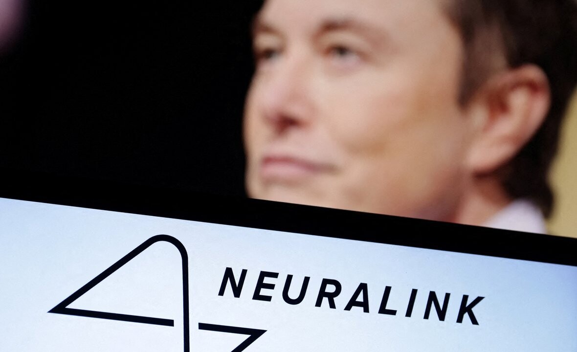 Neuralink наберет трех пациентов для исследования мозговой микросхемы