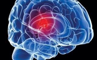AI Model Discovers Brain Tumor Residues Quickly