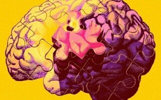 Обнаружена связь между микропластиком и болезнью Альцгеймера
