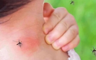 Исследование показывает, что комары притягиваются к определенным цветам летом